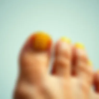 Notable Addressing Yellow Toenails: A Guide for Care and Prevention Notable Addressing Yellow Toenails: A Guide for Care and Prevention