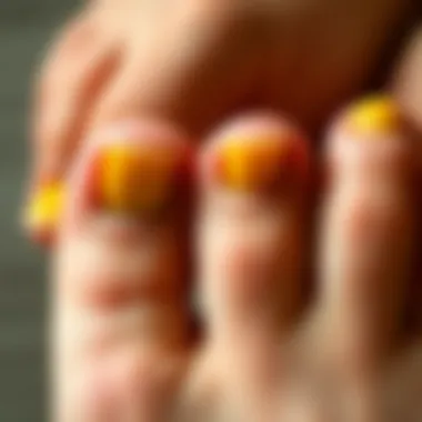 Addressing Yellow Toenails: A Guide for Care and Prevention Summary