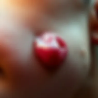 Cystic Acne Explanation Illustration of cystic acne beneath the skin